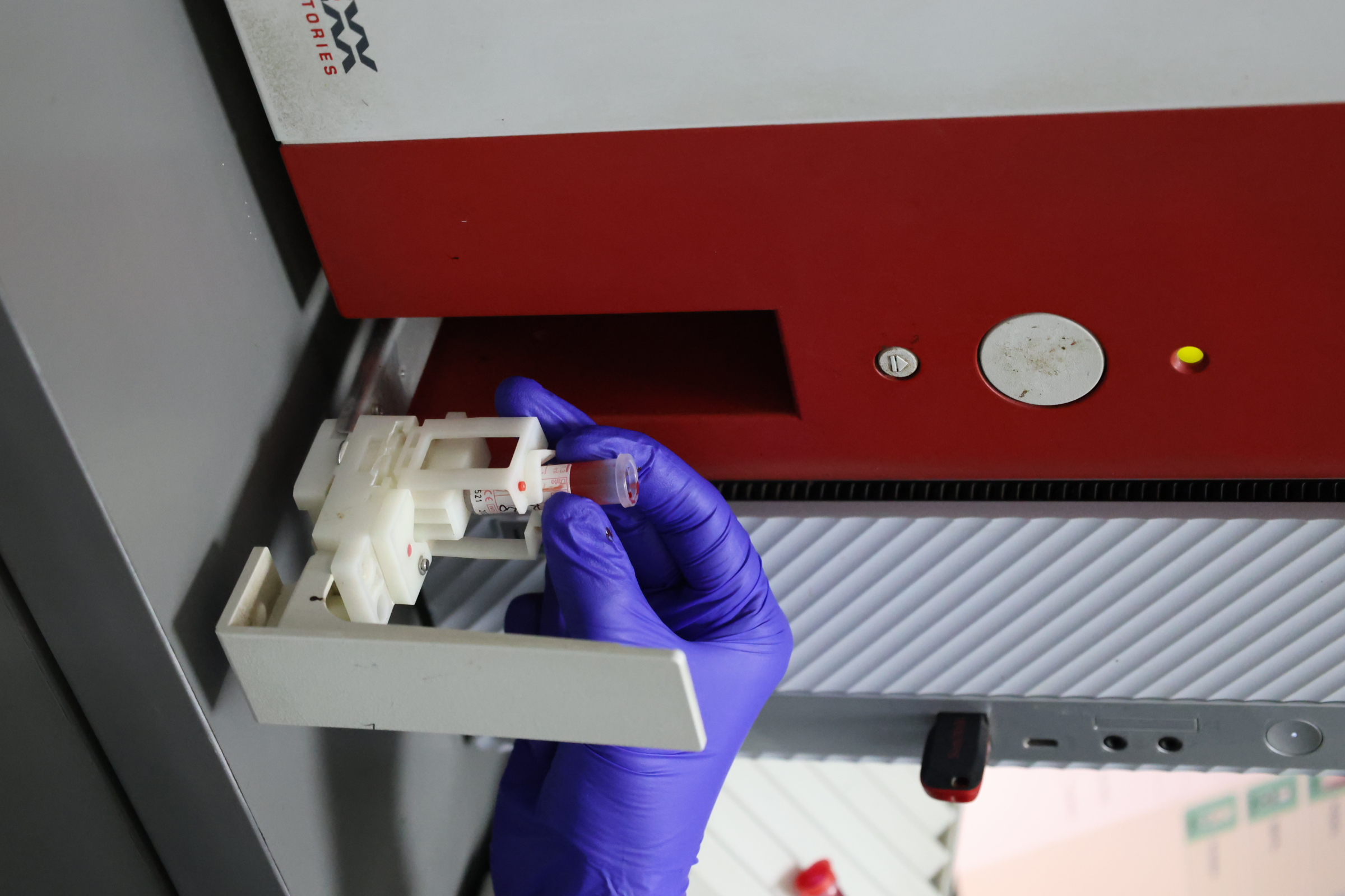 Blood Sample Analysis